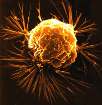 breast%20cancer%20cell.jpg